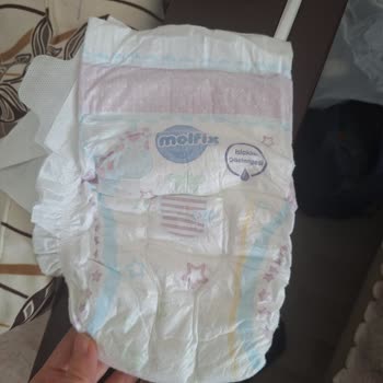 Molfix 6 Numaralı Bezlerde Sürekli Sızdırma Sorunu