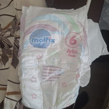 Molfix 6 Numaralı Bezlerde Sürekli Sızdırma Sorunu