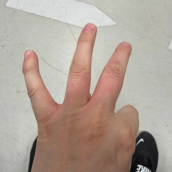 Stanley Termos Patlaması Sonrası Ciddi Yanık ve Güvenlik Riski