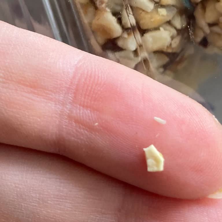 Hurmalı Mix’te Fıstık Kabuğu Bulunması Diş Kırılmasına Yol Açtı