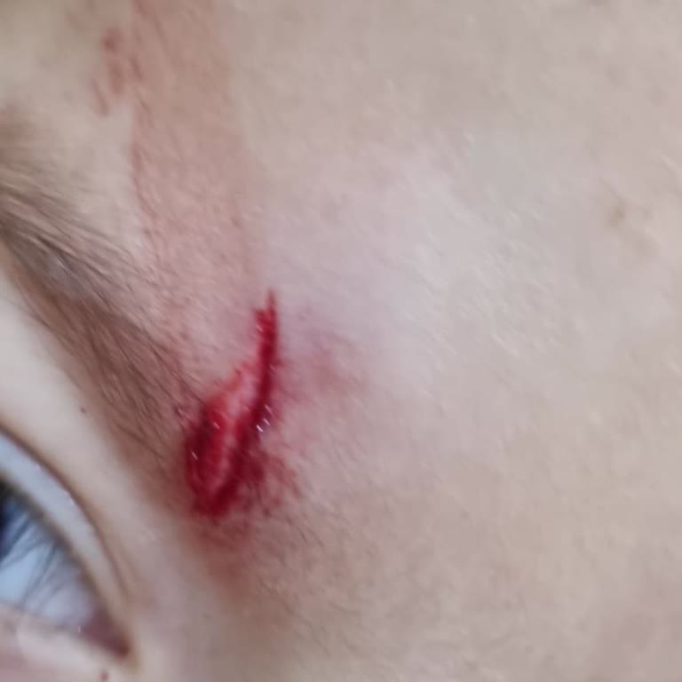 Acil Serviste Çocuğuma Zorla Ek Ücret İstendi Ve İade Talep Ediyorum