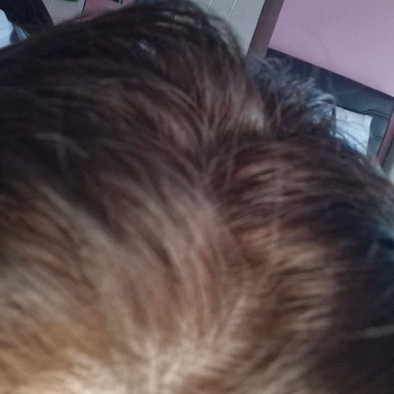 L'Oreal Saç Boyası Turuncuya Dönüştürdü, Kuaför Masrafı Karşılanmalı