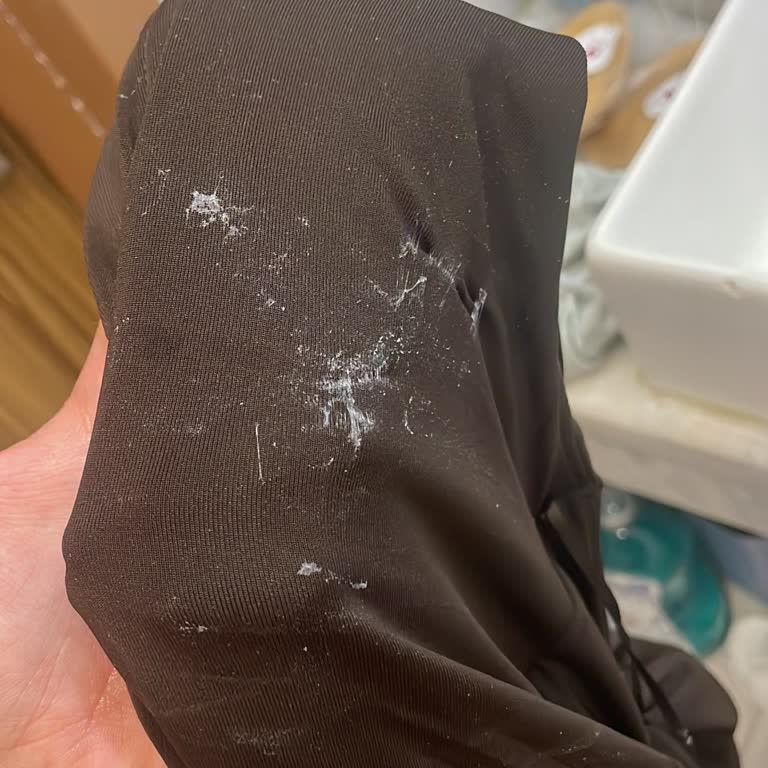 Aşırı Yapışkanlı Göğüs Pedinden Cilt Yanığı Ve Kıyafet Zedelenmesi