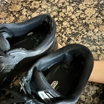 Skechers Ayakkabısında Ciddi Deformasyon Ve Mağazada Değişim Reddi