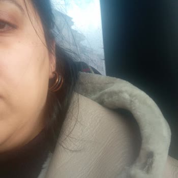 Kurklu Montta Kürk Parçasının Düşmesi Kullanıcı Hatası Olarak Red Edildi