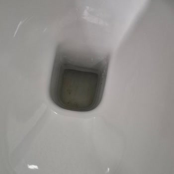 Turkuaz Duru Klozette Sürekli Leke Ve Hijyen Sorunu