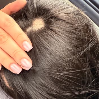 Urban Biotin Keratin Şampuanı Saç Derisinde Şişlik Ve Yanma Sebep Oldu