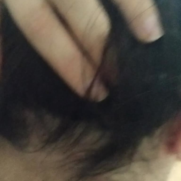 Urban Biotin Keratin Şampuanı Saç Derisinde Şişlik Ve Yanma Sebep Oldu