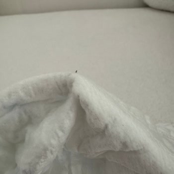 Bebek Bezinde Metal Ve Sivri Parça Bulunması