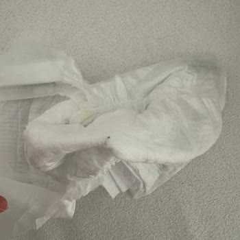 Bebek Bezinde Metal Ve Sivri Parça Bulunması