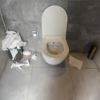 Üsküdar Çocuk Köyü Tuvaletlerinde Hijyen İhmali Ve Sürekli Kirli Ortam