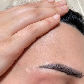 Kaş Kaldırma Sonrası Kalıcı İzler Ve Yetersiz Tazminat Şikayeti