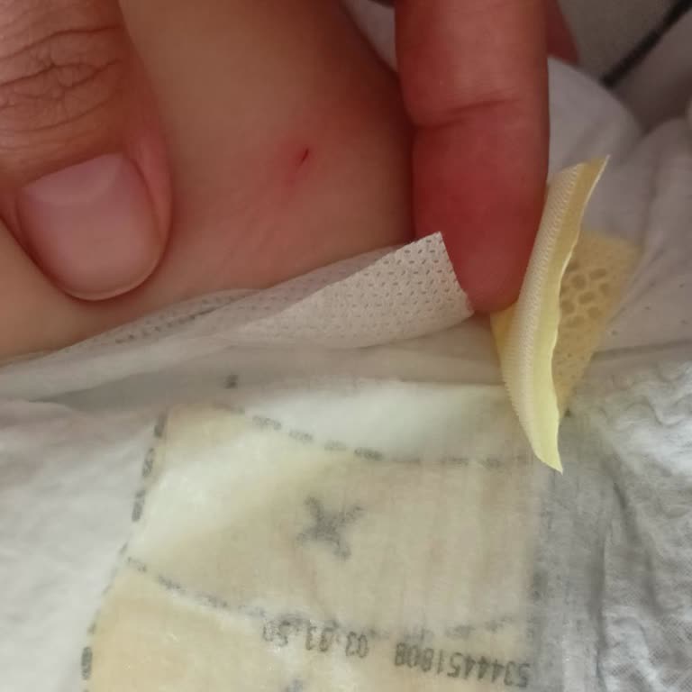 Bebek Bezinin Sarı Bantları Bacağı Kesti Ve Üçüncü Kez Cevap Alınamadı