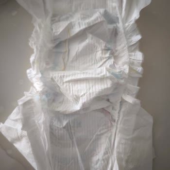 Molfix Bebek Bezinde Pamuk Eksikliği Ve Hijyen Endişesi