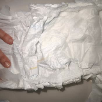 Molfix Bebek Bezinde Pamuk Eksikliği Ve Hijyen Endişesi