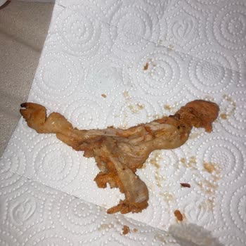 Keskinoğlu Piliç Dönerinde Deri Parçası Çıktı