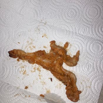 Keskinoğlu Piliç Dönerinde Deri Parçası Çıktı