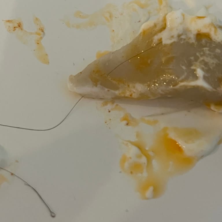 Ekmecik Kıymalı Matta İçinde Saç Bulunması Ve Hijyen Endişesi