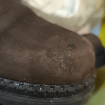 Greyder Botta Kısa Sürede Deforme, Kullanıcı Hatası İddiası Ve Çözüm Yok