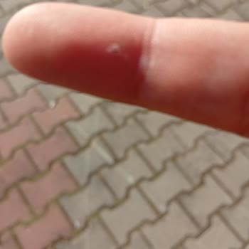 Antalya Aktur Park’ta Boks Makinesinde Elektrik Çarpması: Can Güvenliği Tehlikede