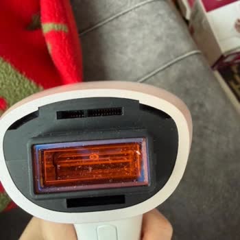 Media Markt'tan Kullanılmış Ve Kirli Lazer Epilasyon Cihazı İade Talebi