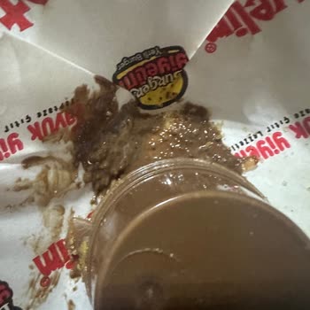 Çocuğuma Gelen Yemekte Tel Bulunması Ve Şekerli Ürün Gönderimi İle Sağlık Riski