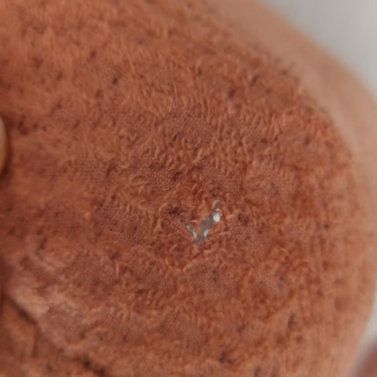 Delikli Berjerin Değişimi İçin Uzun Süre Bekleme