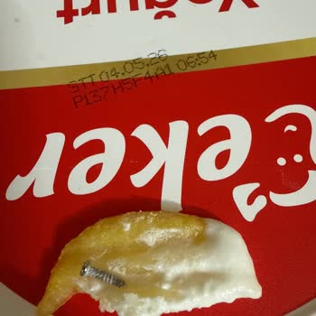 Yoğurttan Çıkan Vida Çocuğumu Tehlikeye Attı