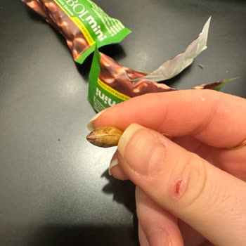 Kahve Dünyası Çikolatasında Kabuklu Fıstık Ve Diş Riski