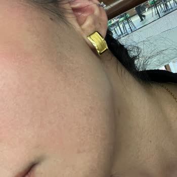 Cildime Zarar Veren Ve Orijinal Olmadığı Şüpheli Fondöten İçin Tam İade Talebi