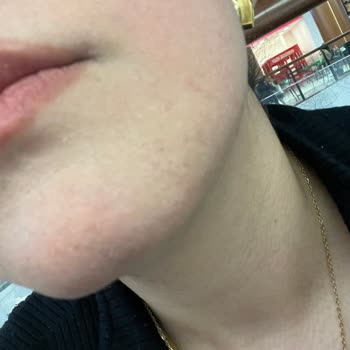 Cildime Zarar Veren Ve Orijinal Olmadığı Şüpheli Fondöten İçin Tam İade Talebi