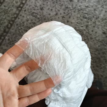 Molfix Bebek Bezinde Üretim Hatası: Pamuk Sızıntısı Ve Hijyen Endişesi