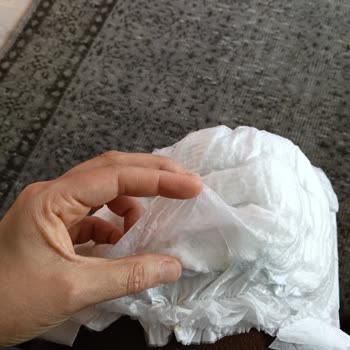 Molfix Bebek Bezinde Üretim Hatası: Pamuk Sızıntısı Ve Hijyen Endişesi