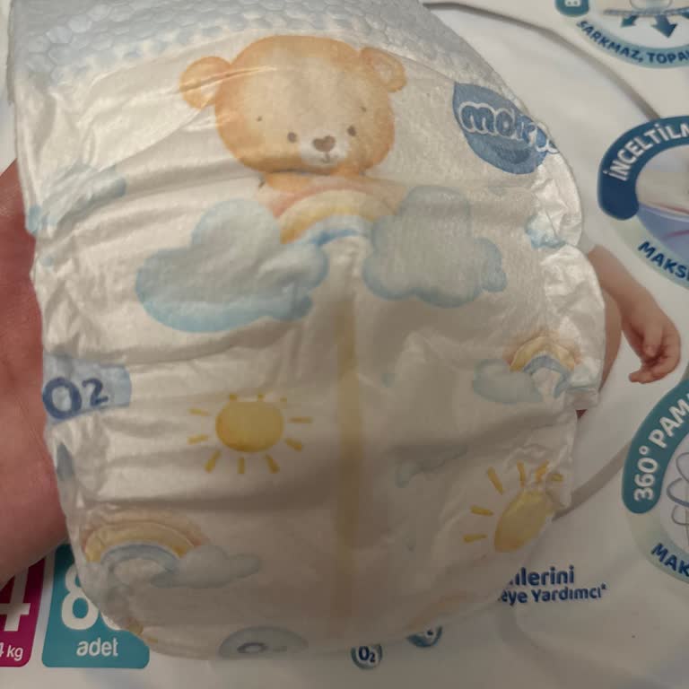 Molfix Premium Smart Fit Bebek Bezleri Sızdırma Ve Uykusuzluk Sorunu