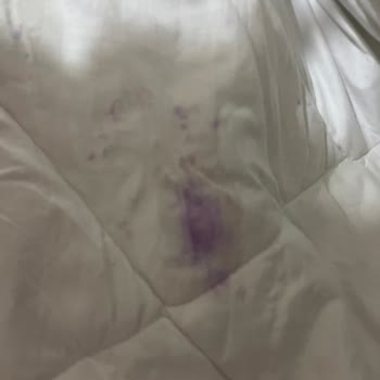 Doa Çamaşır Parfümü Lavanta Kokulu Üründe Mosmor Lekeler Ve Kumaş Sertleşmesi