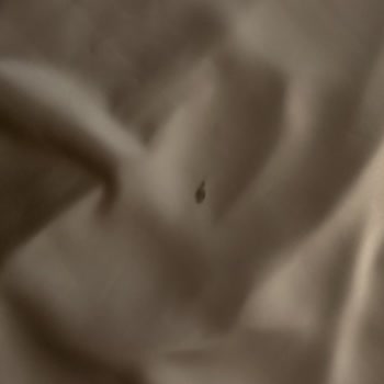 Leke İçeren Abiyede Ciddiyetsiz İade Süreci Ve İletişim Eksikliği