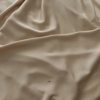 Leke İçeren Abiyede Ciddiyetsiz İade Süreci Ve İletişim Eksikliği