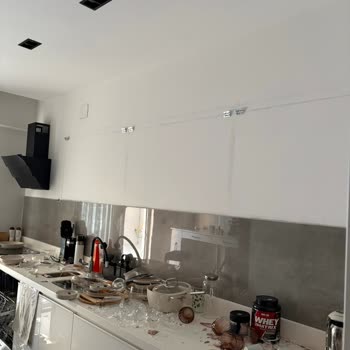 Düşen Mutfak Dolabı Nedeniyle Ciddi Yaralanma Ve Tazminat Talebi