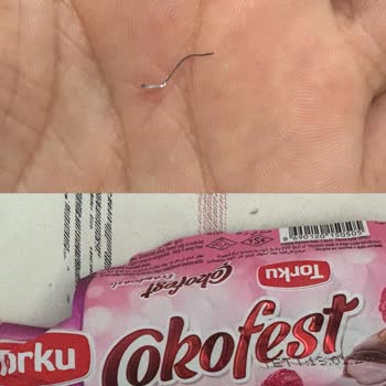 Torku Çokofest Ürününde Metal Parça Bulunması Ve Ağız Yaralanması