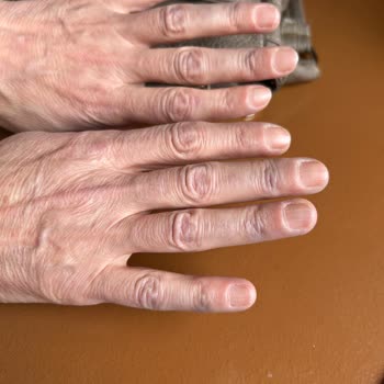 Network Pantolonunda Boya Sorunu, Değişim Talebi