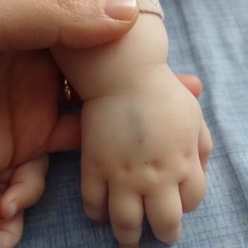 Aksaray İnova Hastanesi Acil Serviste Çocuğun Gereksiz Kan Alımı Denemeleri Ve Personel Yetersizliği