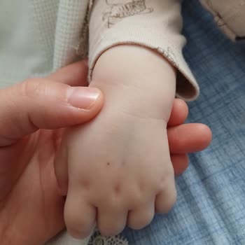 Aksaray İnova Hastanesi Acil Serviste Çocuğun Gereksiz Kan Alımı Denemeleri Ve Personel Yetersizliği