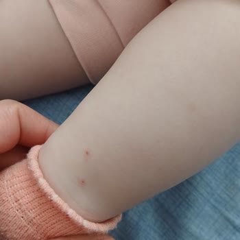 Aksaray İnova Hastanesi Acil Serviste Çocuğun Gereksiz Kan Alımı Denemeleri Ve Personel Yetersizliği