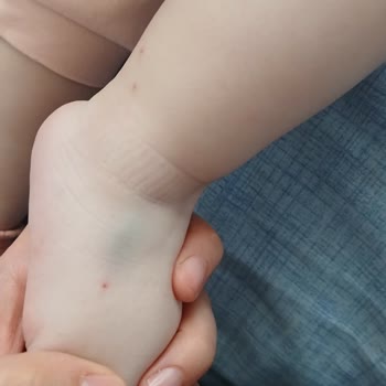 Aksaray İnova Hastanesi Acil Serviste Çocuğun Gereksiz Kan Alımı Denemeleri Ve Personel Yetersizliği