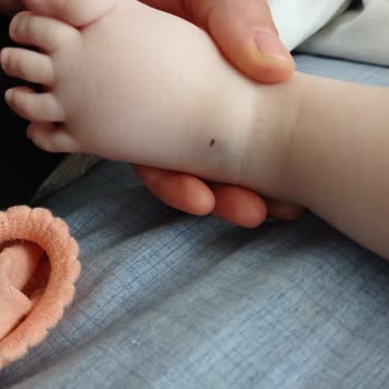 Aksaray İnova Hastanesi Acil Serviste Çocuğun Gereksiz Kan Alımı Denemeleri Ve Personel Yetersizliği