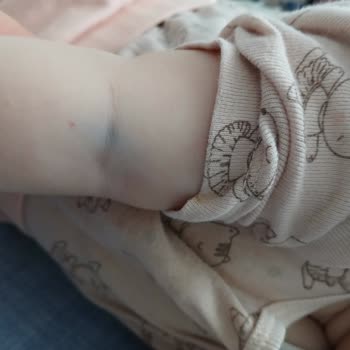 Aksaray İnova Hastanesi Acil Serviste Çocuğun Gereksiz Kan Alımı Denemeleri Ve Personel Yetersizliği