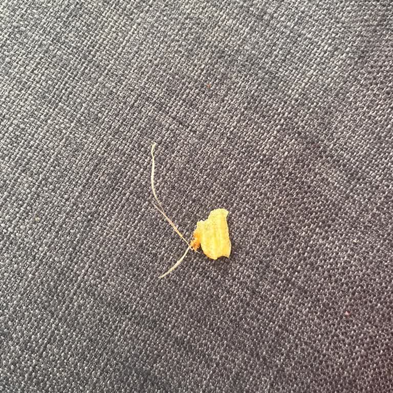 Ruffles Çipsinde Yabancı Madde Bulunması Sağlık Endişesi Yarattı