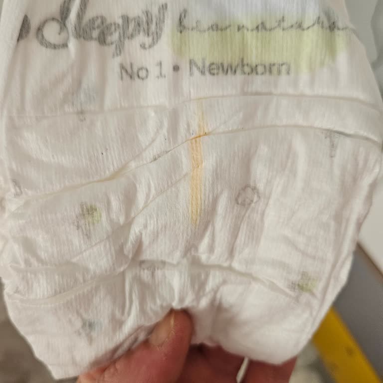 Sızdıran Bebek Bezinden Şikayet Ve Hızlı Çözüm Talebi