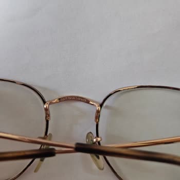 Metal Çerçeveli Ray-Ban Gözlüğü Cildimi Tahriş Ediyor, Değişim Talebim Reddedildi