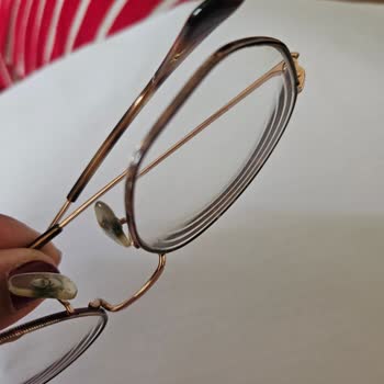 Metal Çerçeveli Ray-Ban Gözlüğü Cildimi Tahriş Ediyor, Değişim Talebim Reddedildi